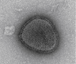 Abbildung des Newcastle Disease Virus